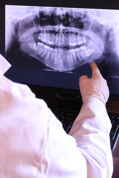 Best Emergency Dentist for Lost Fillings or Crowns in Guyton, GA